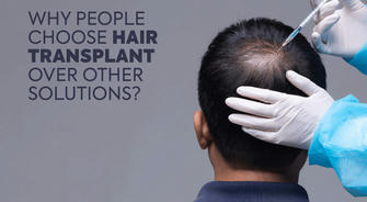 Why Are More People Choosing Hair Transplants?